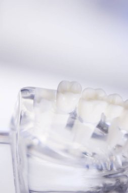 Diş hekimleri diş diş modeli