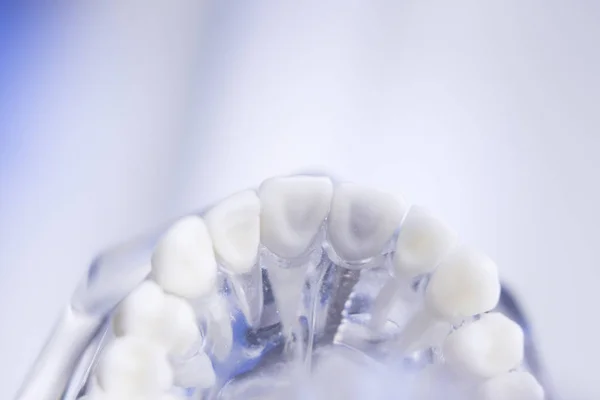 Dentisti modello dentale — Foto Stock