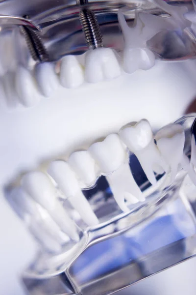 Dentistas modelo de dientes dentales —  Fotos de Stock