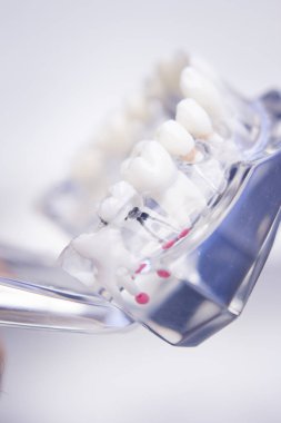 Diş hekimleri diş diş modeli