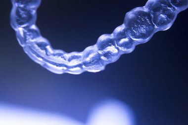 Görünmez diş parantez aligners