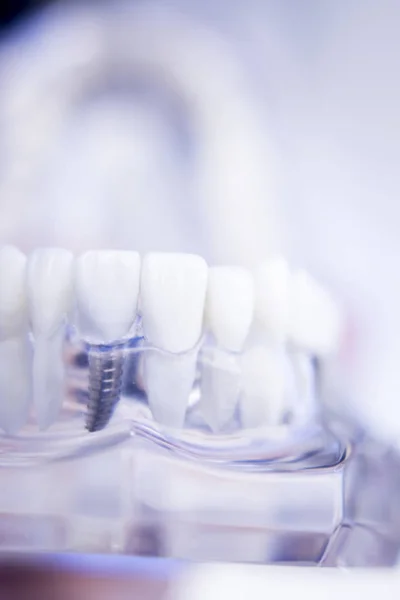 Dentisti modello dentale — Foto Stock