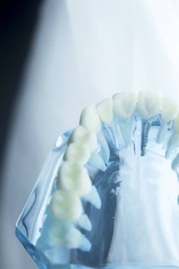 Diş diş diş hekimliği modeli