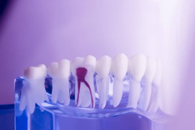 Diş diş diş hekimliği modeli