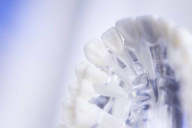 Diş hekimleri diş diş modeli