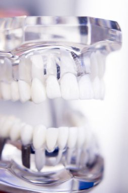 Diş hekimleri diş diş modeli