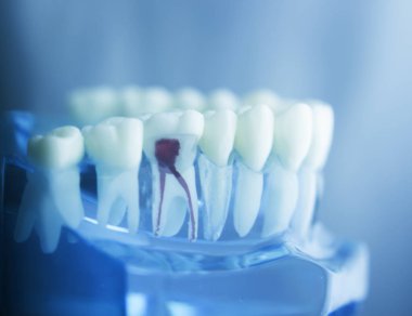 Diş diş kök modeli