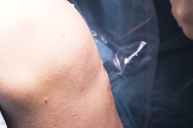 Cerrahi operasyon diz cerrahisi