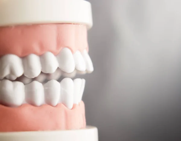 Οδοντιατρική δόντια μοντέλο οδοντιατρικής — Φωτογραφία Αρχείου