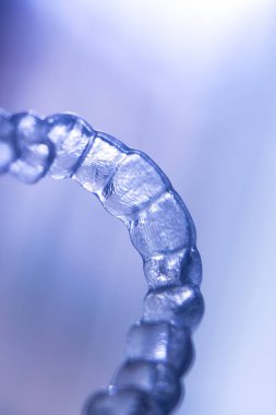 Görünmez Ortodonti parantez