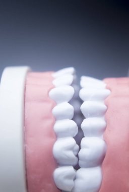 Diş diş diş hekimliği modeli