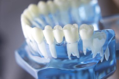 Diş diş diş hekimliği modeli