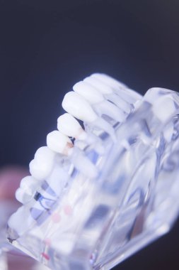 Diş hekimleri diş diş modeli