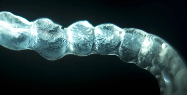 Ортодонтія стоматологічна фігурна дужка — стокове фото