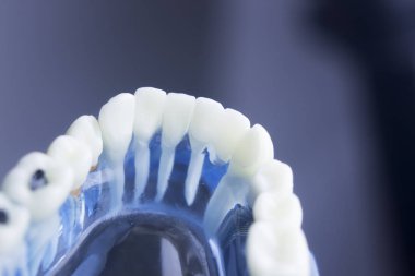 Diş diş diş hekimliği modeli