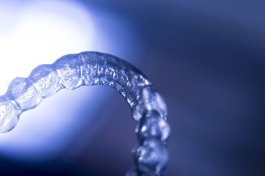 Görünmez Ortodonti parantez