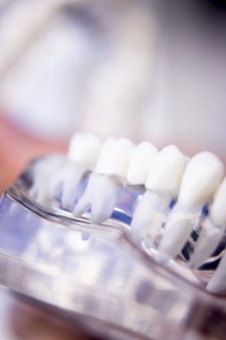 Diş hekimleri diş diş modeli