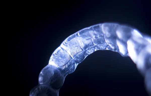 Zubní rovnátka ortodoncie — Stock fotografie