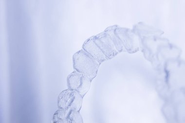 Görünmez diş diş parantez