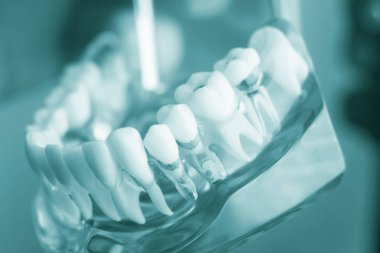 Diş diş diş hekimliği modeli