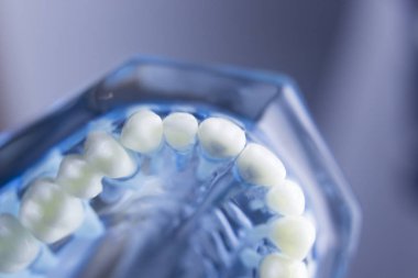 Diş diş diş hekimliği modeli