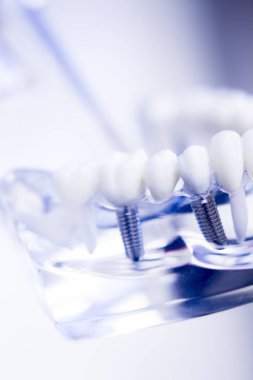 Diş hekimleri diş diş modeli