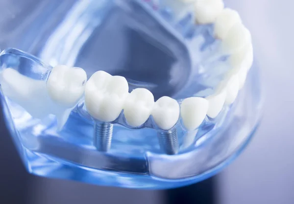 Modelo de odontología dental — Foto de Stock