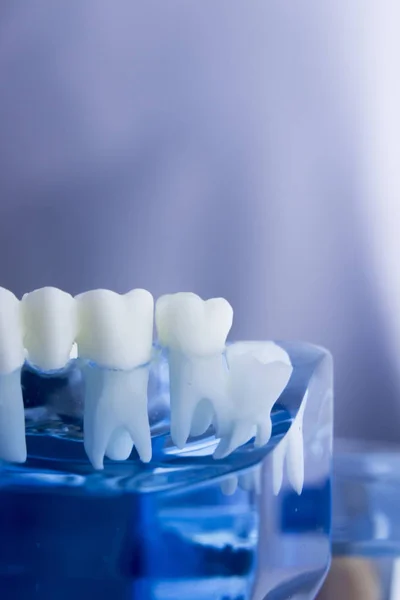 Modelo de odontología dental —  Fotos de Stock