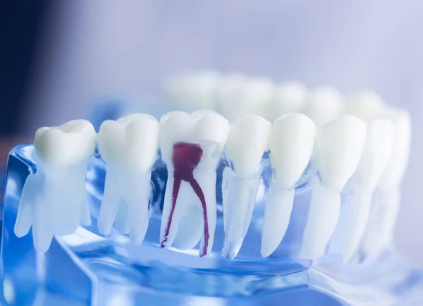 Modelo de raiz dentária — Fotografia de Stock