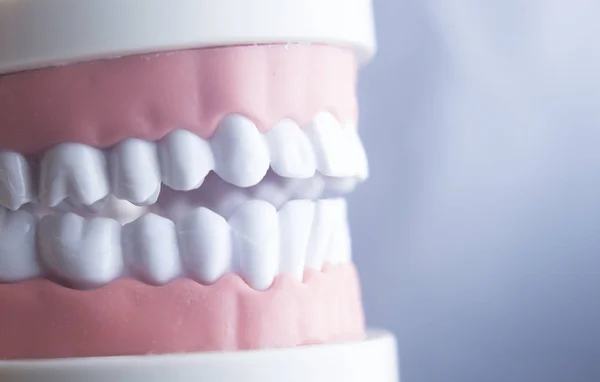 Dental teeth dentistry model — Stock Photo, Image