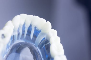 Diş diş diş hekimliği modeli