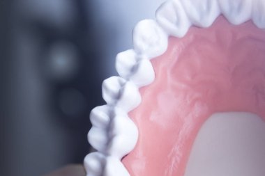 Diş diş diş hekimliği modeli