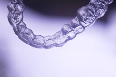 Görünmez diş parantez aligners