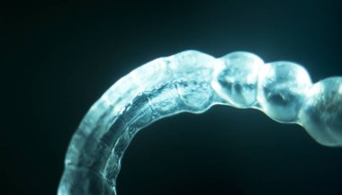 Ortodonti diş küme ayracı