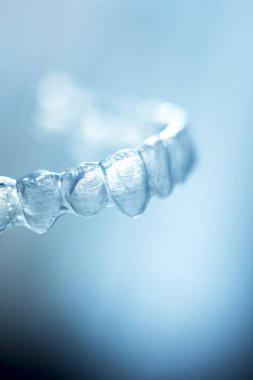 Görünmez Ortodonti parantez