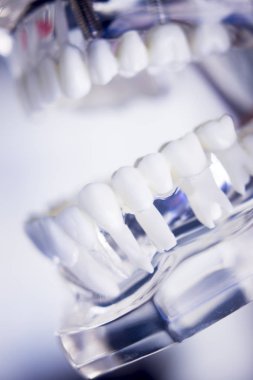 Diş hekimleri diş diş modeli