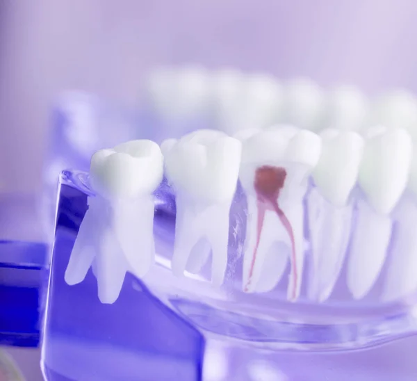 Modelu korzeń zęba dentystyczny — Zdjęcie stockowe