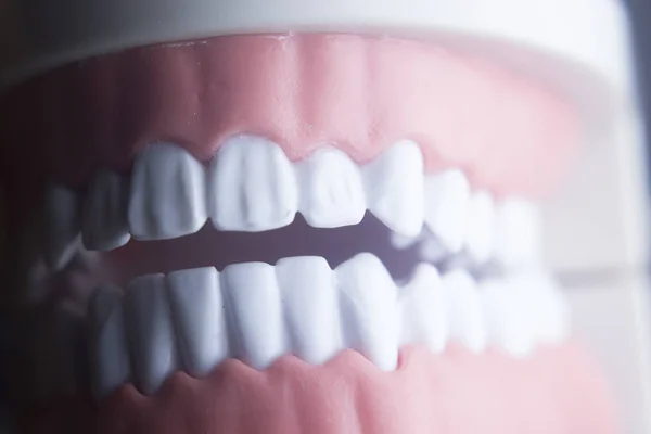 Fogászati fogak fogászat modell — Stock Fotó