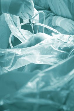 Diz cerrahisi Hastanesi işlemi