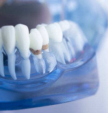 Diş diş diş hekimliği modeli