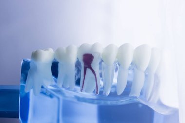 Diş diş diş hekimliği modeli