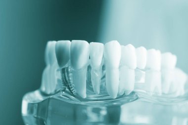 Diş diş diş hekimliği modeli