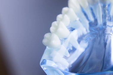 Diş diş diş hekimliği modeli