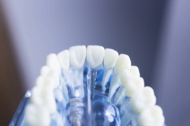 Diş diş diş hekimliği modeli