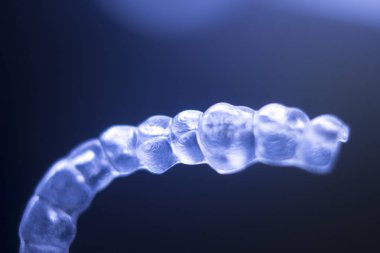 Görünmez diş parantez aligners