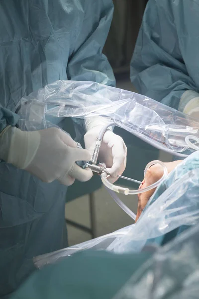 Cirurgia do joelho operação hospitalar — Fotografia de Stock