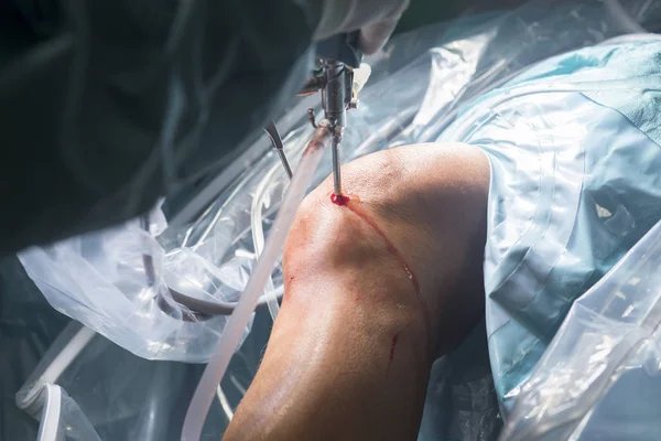 Knee surgery hospital operation