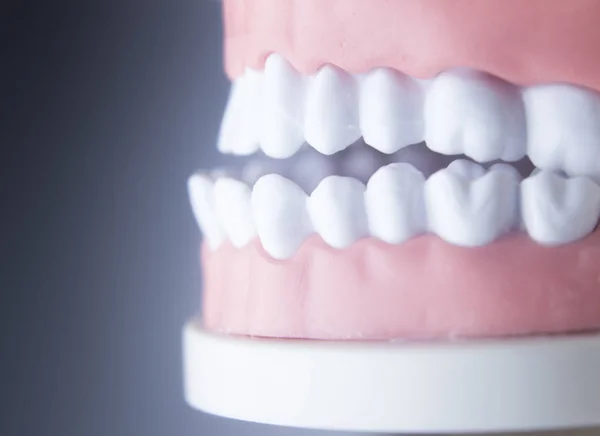 Modello di odontoiatria dentale — Foto Stock