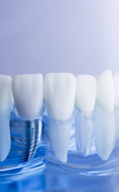 Diş diş diş hekimliği modeli