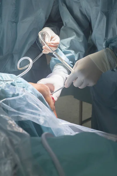 Térd sebészet Kórház működését — Stock Fotó